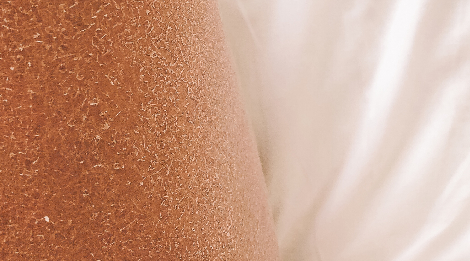 How to Treat Dry Skin