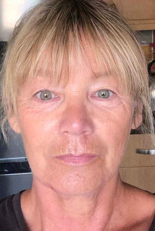 Image of Absoluter Isobel before using Absolute Collagen's Collagen Supplement