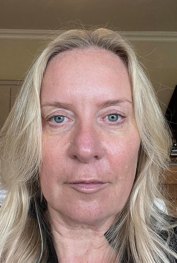 Image of Absoluter Paula after taking Absolute Collagen, Marine Collagen Supplements